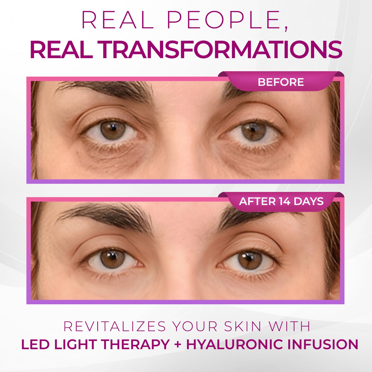 EMS Eye Red light Eye Massager - Reduce Wrinkles & Relax your eyes