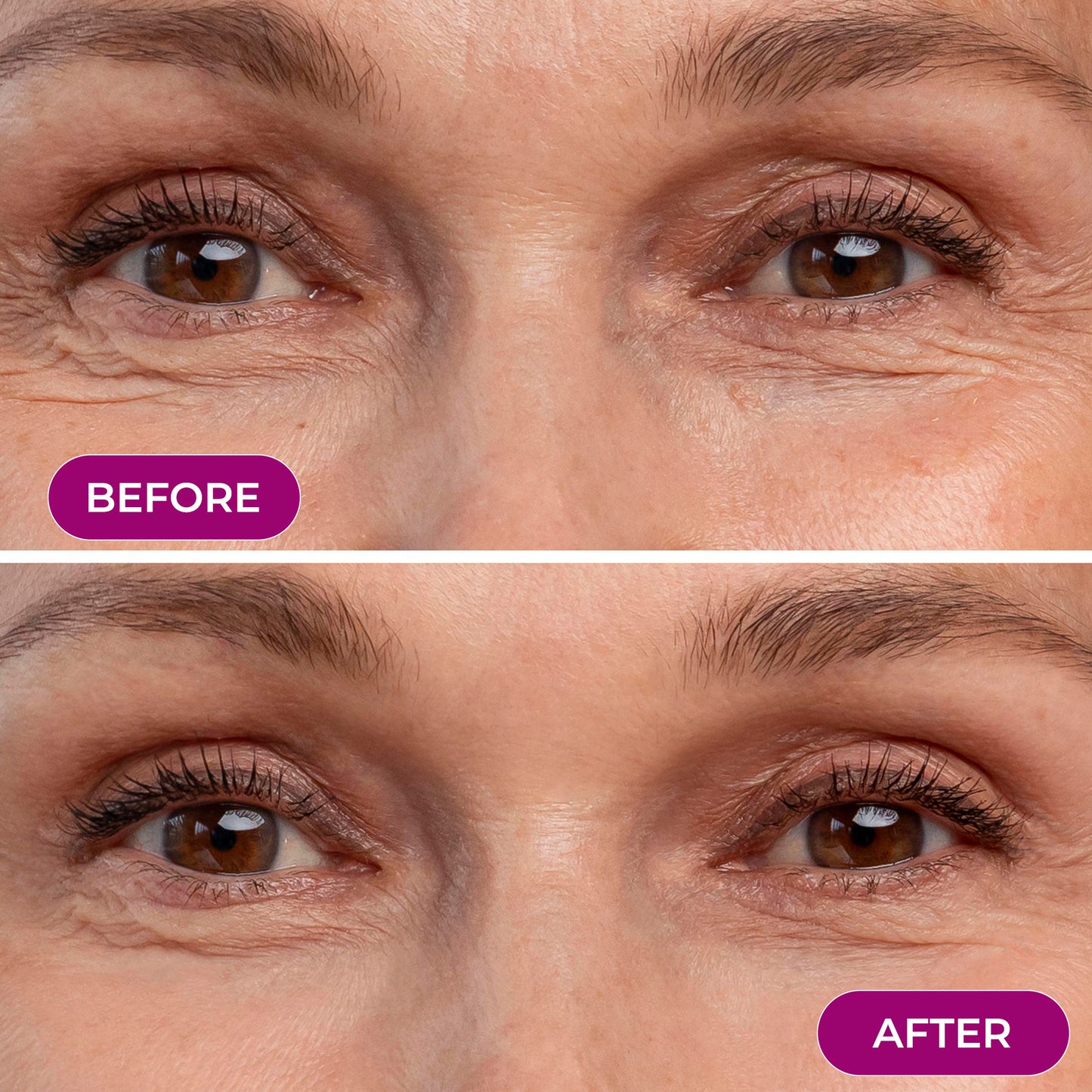EMS Eye Red light Eye Massager - Reduce Wrinkles & Relax your eyes