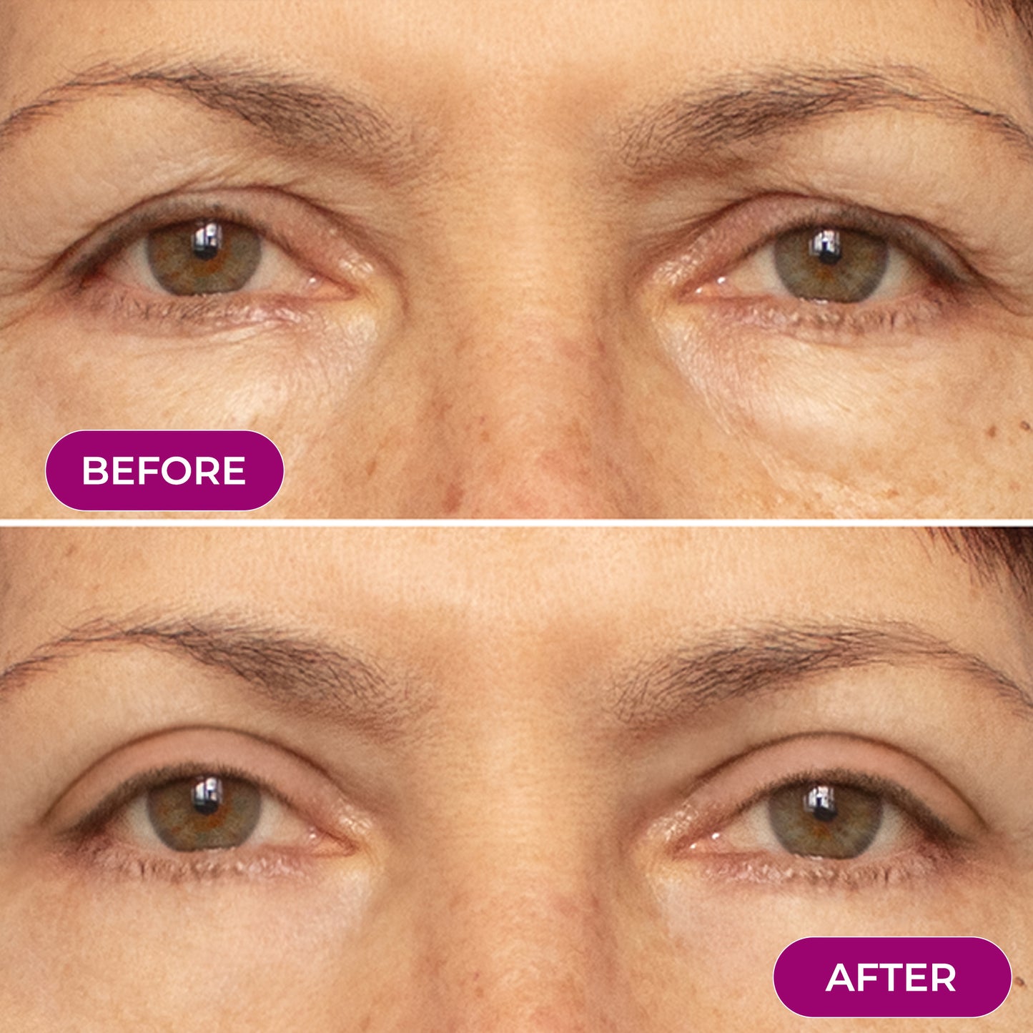 EMS Eye Red light Eye Massager - Reduce Wrinkles & Relax your eyes