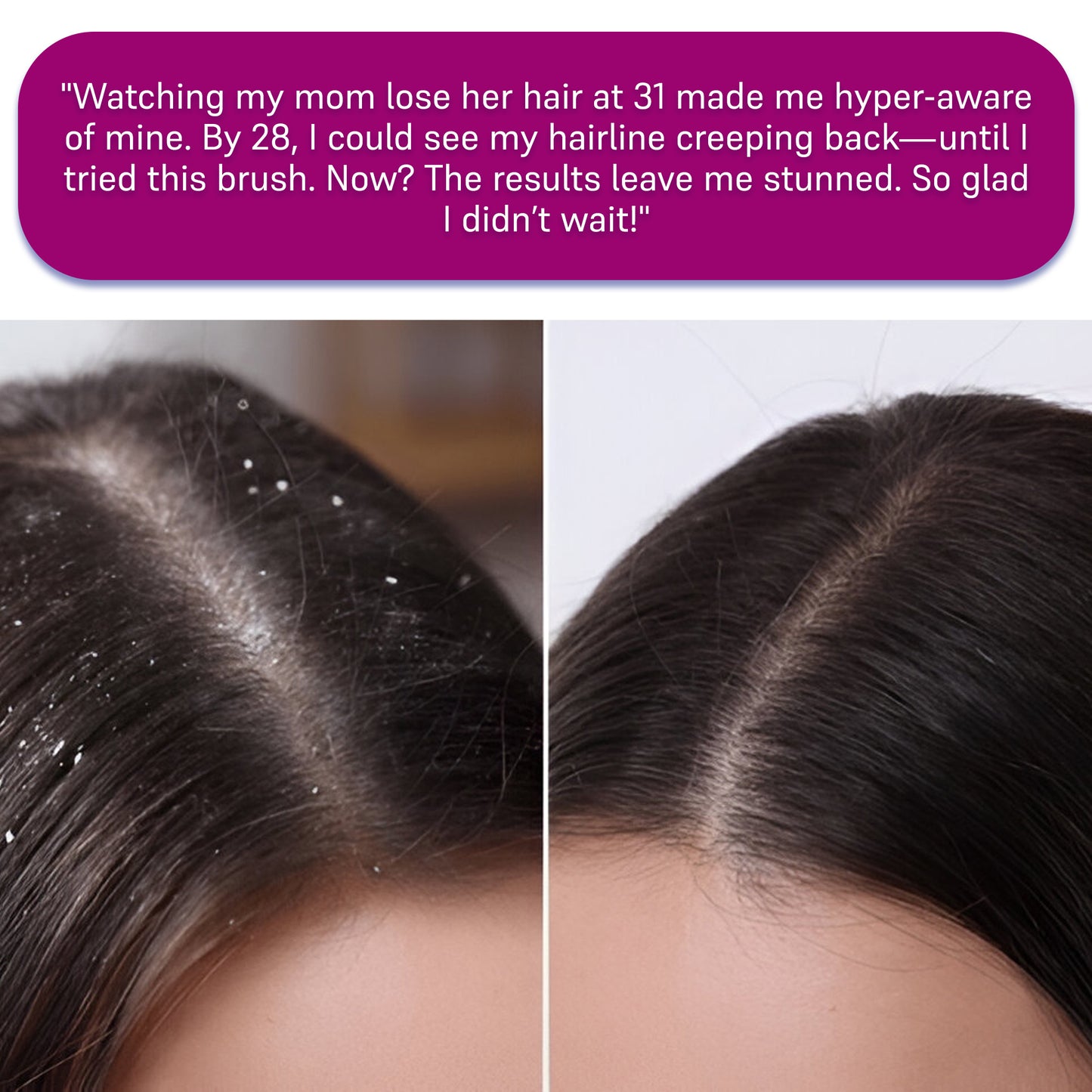 Electric Scalp Massager Brush