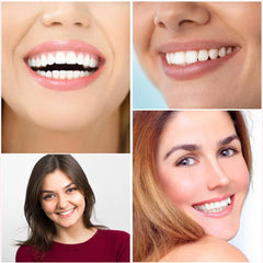 Denture Molds for Teeth (Top & Bottom) - Get Instant Veneers Smile & Confidence