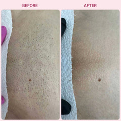 Instant Smooth Hair Eraser Pain Free