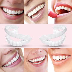 Denture Molds for Teeth (Top & Bottom) - Get Instant Veneers Smile & Confidence