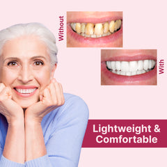 Denture Molds for Teeth (Top & Bottom) - Get Instant Veneers Smile & Confidence