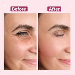 Anti Wrinkle Reusable Silicone Patches