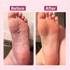 Electric Foot File Hard Skin Remover