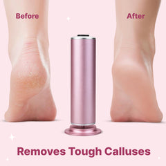 Electric Callus Foot Remover