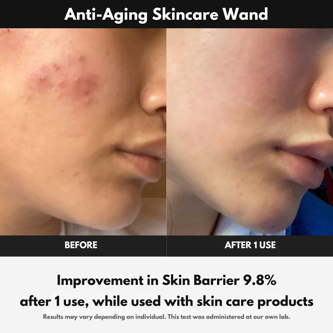 GlowVitalize™ Anti-Aging Skincare Wand - Get Healthier and Glazed Skin