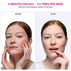 Rejuvenate Wand for Skin, Dark Circles & Massage
