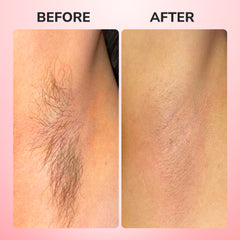 3-in-1 Rechargeable Hair Epilator with Electric Tweezers for Legs and Arms
