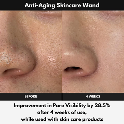 GlowVitalize™ Anti-Aging Skincare Wand - Get Healthier and Glazed Skin