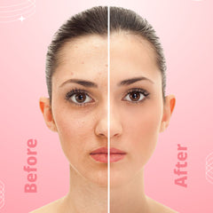 Skin Rejuvenation Face Mask