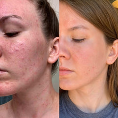 Skin Rejuvenation Face Mask