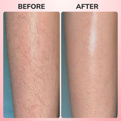 3-in-1 Rechargeable Hair Epilator with Electric Tweezers for Legs and Arms