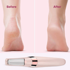Electric Foot File Hard Skin Remover