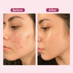Turmeric Kojic Pads - Brightens & Evens Skin Tone (2-PACK)