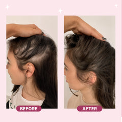Scalp Massager Spray Brush - First Science-Backed Brush