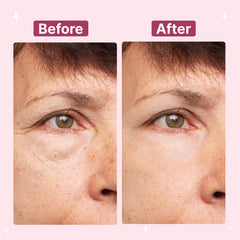 Anti Wrinkle Reusable Silicone Patches