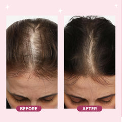 Scalp Massager Spray Brush - First Science-Backed Brush
