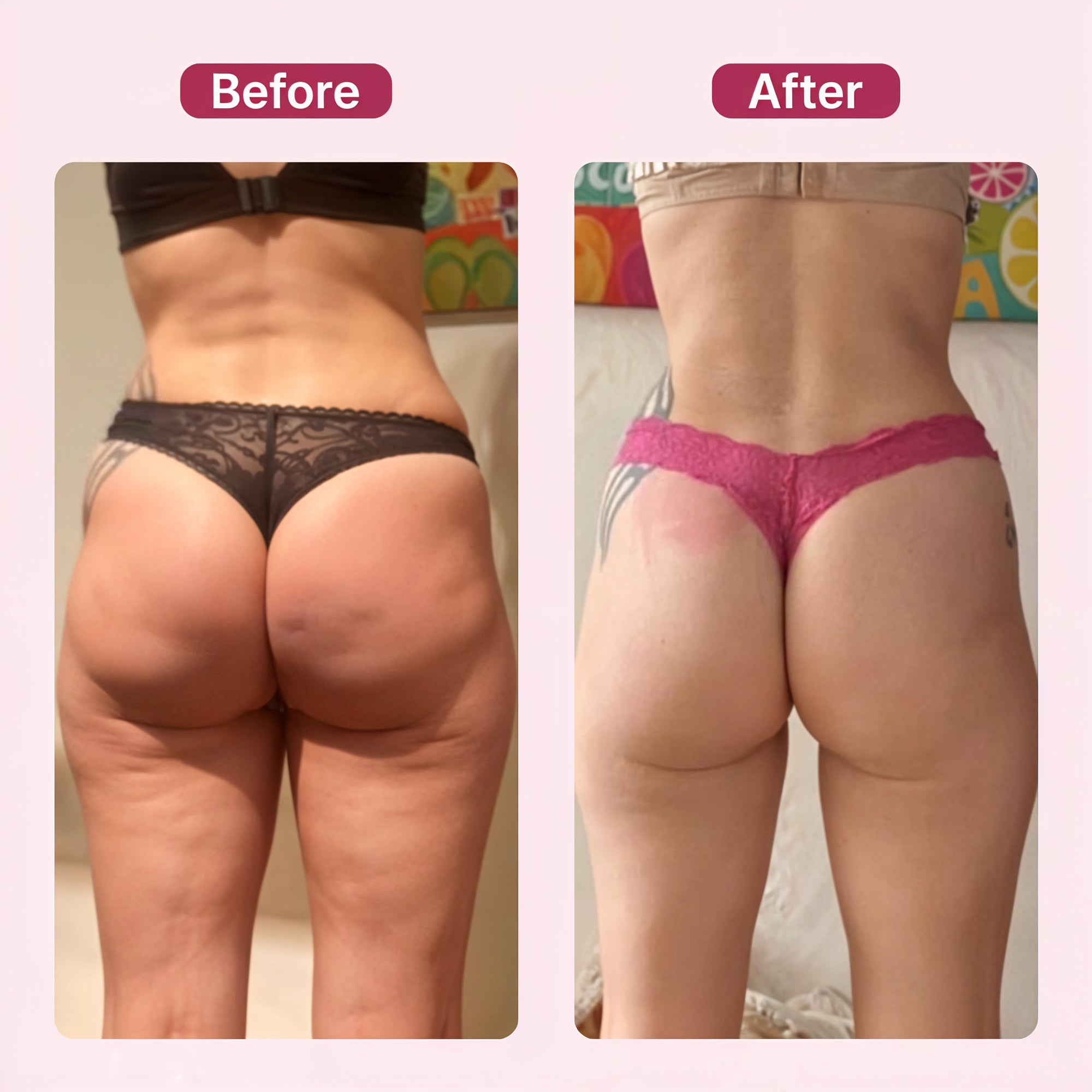 Ultrasonic Fat & Cellulite Burner