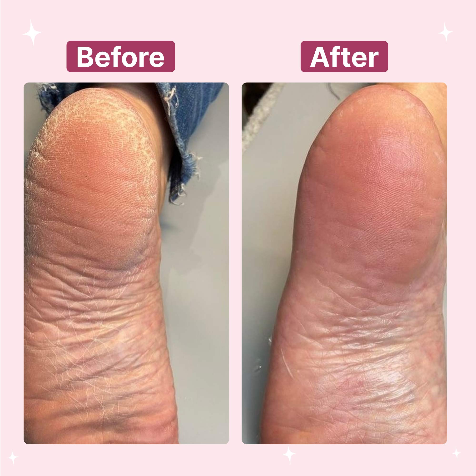 Electric Foot File Hard Skin Remover
