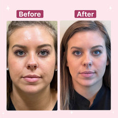 Anti Wrinkle Reusable Silicone Patches