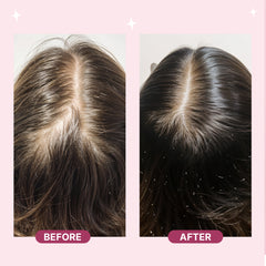 Scalp Massager Spray Brush - First Science-Backed Brush