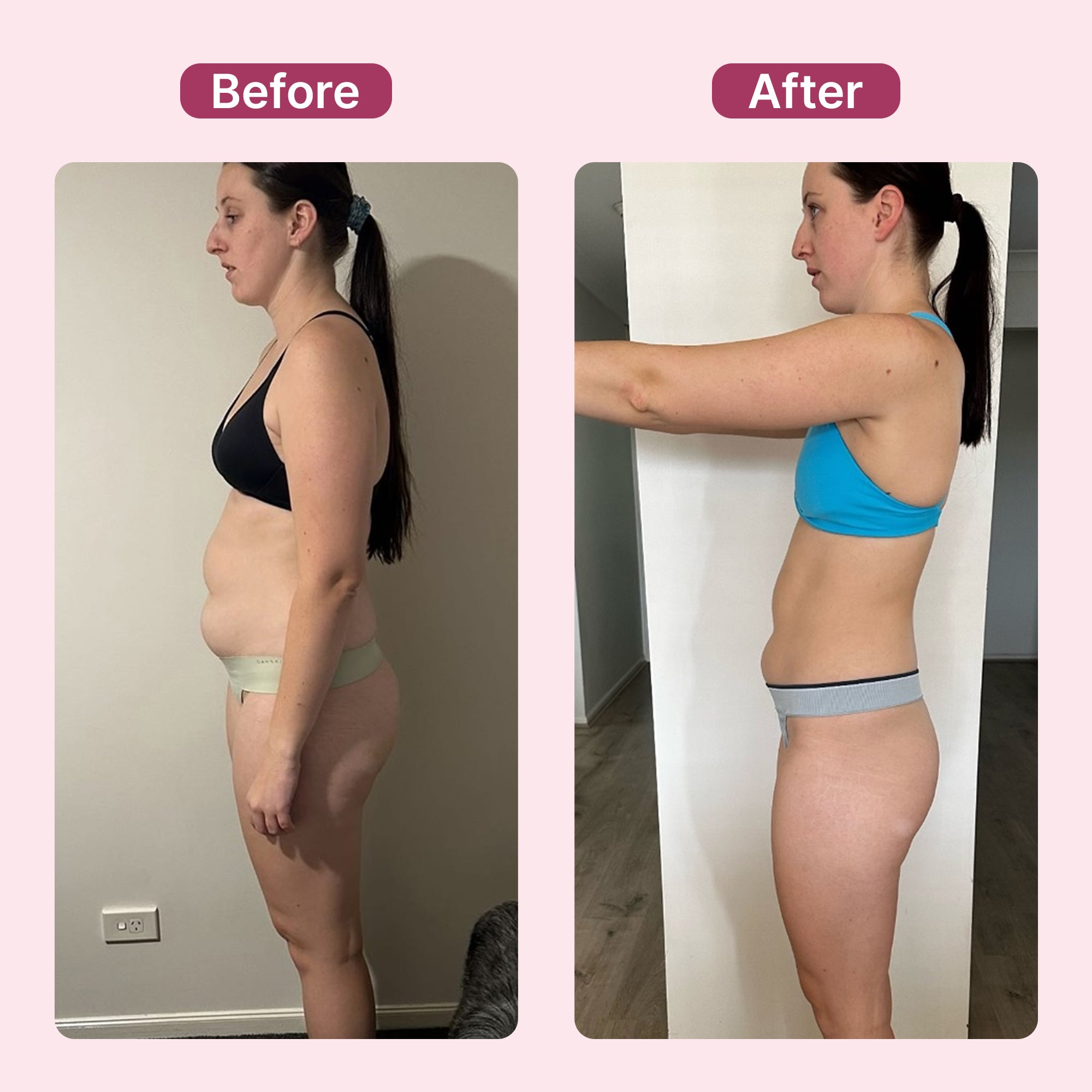 Ultrasonic Fat & Cellulite Burner