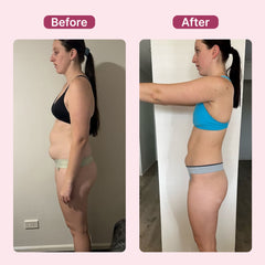 Ultrasonic Fat & Cellulite Burner