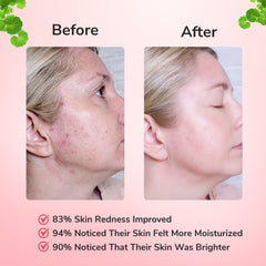 Bio-Collagen Deep Mask - Anti-Wrinkle Lifting Korean Mask for Deep Collagen Renewal