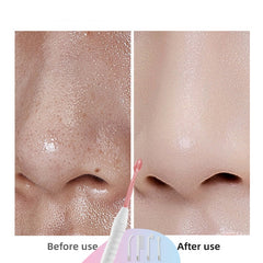 4-in-1 High Frequency Electrode Wand for Acne Spot Removal, Anti-Wrinkle Skin and Hair Care