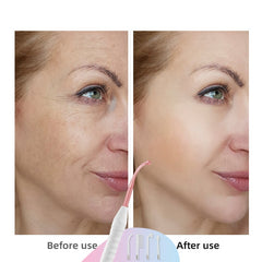 4-in-1 High Frequency Electrode Wand for Acne Spot Removal, Anti-Wrinkle Skin and Hair Care