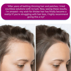 Electric Scalp Massager Brush